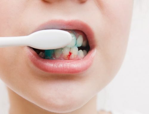 Gums Bleeding While Brushing or Flossing
