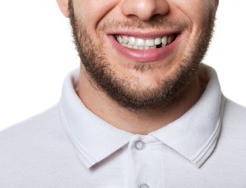 I Have Missing Teeth. What Do I Do?