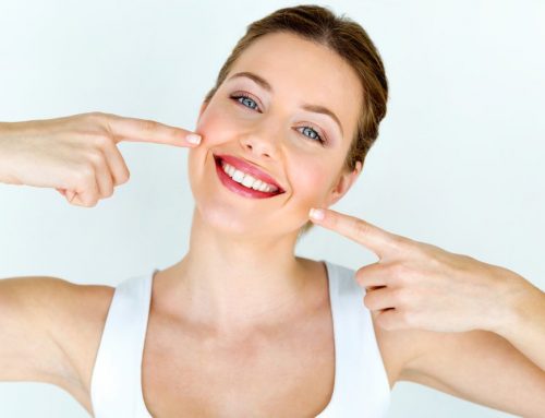 What is a Smile Makeover?