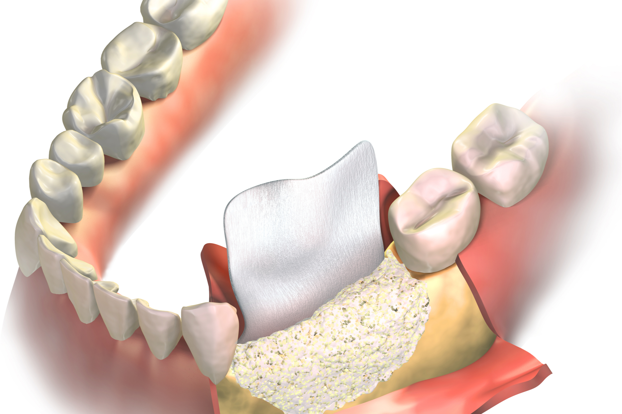 Oral Surgery